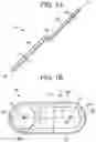 Fig. 02 - Offset rods, offset rod connectors, and related methods