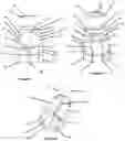 Fig. 03 - Advanced Polyaxial System and Surgical Procedure