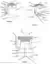 Fig. 04 - Advanced Polyaxial System and Surgical Procedure