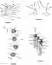 Fig. 16 - Advanced Polyaxial System and Surgical Procedure