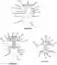 Fig. 19 - Advanced Polyaxial System and Surgical Procedure