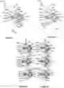 Fig. 22 - Advanced Polyaxial System and Surgical Procedure