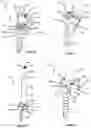 Fig. 23 - Advanced Polyaxial System and Surgical Procedure