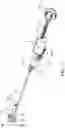Fig. 06 - Flow diverter for bone cement delivery systems