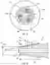 Fig. 05 - Orthopedic screw extractor