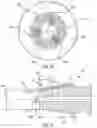 Fig. 07 - Orthopedic screw extractor