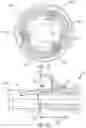 Fig. 09 - Orthopedic screw extractor