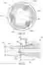 Fig. 11 - Orthopedic screw extractor
