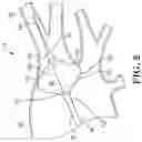 Fig. 03 - System and method for inflating a cryoablation balloon catheter