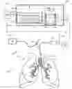 Fig. 01 - FLUID DELIVERY SYSTEM AND METHOD FOR TREATMENT