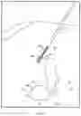 Fig. 16 - Flexible RF ablation needle