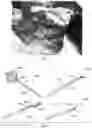 Fig. 18 - Flexible RF ablation needle