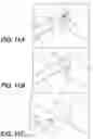 Fig. 10 - Medical devices and related methods