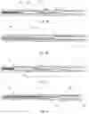 Fig. 03 - RADIO FREQUENCY ABLATION CATHETER AND SYSTEM