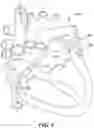 Fig. 07 - Augmented reality solution to optimize the directional approach and therapy delivery of interventional cardiology tools