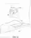 Fig. 13 - Augmented reality solution to optimize the directional approach and therapy delivery of interventional cardiology tools