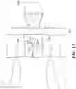 Fig. 14 - Augmented reality solution to optimize the directional approach and therapy delivery of interventional cardiology tools