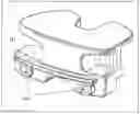 Fig. 02 - Method and device for patient specific instruments for one stage and two stages of revision knee arthroplasty using constraint and hinged knee implant