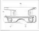 Fig. 03 - Method and device for patient specific instruments for one stage and two stages of revision knee arthroplasty using constraint and hinged knee implant