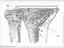 Fig. 07 - Method and device for patient specific instruments for one stage and two stages of revision knee arthroplasty using constraint and hinged knee implant