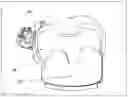 Fig. 10 - Method and device for patient specific instruments for one stage and two stages of revision knee arthroplasty using constraint and hinged knee implant