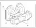 Fig. 11 - Method and device for patient specific instruments for one stage and two stages of revision knee arthroplasty using constraint and hinged knee implant