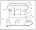 Fig. 13 - Method and device for patient specific instruments for one stage and two stages of revision knee arthroplasty using constraint and hinged knee implant