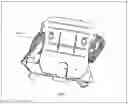 Fig. 20 - Method and device for patient specific instruments for one stage and two stages of revision knee arthroplasty using constraint and hinged knee implant