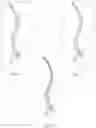 Fig. 03 - Methods, systems, and devices for designing and manufacturing a spinal rod