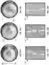 Fig. 11 - Autonomous system and method for planning, tracking, and controlling the operation of steerable surgical devices