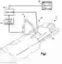 Fig. 02 - Robotic surgery