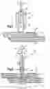 Fig. 03 - Robotic surgery