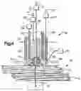 Fig. 04 - Robotic surgery