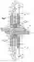Fig. 06 - Robotic surgery