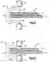 Fig. 11 - Robotic surgery