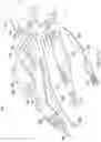 Fig. 11 - Surgical arm system with internally drive gear assemblies