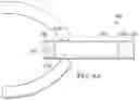 Fig. 30 - Surgical arm system with internally drive gear assemblies