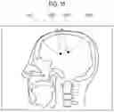 Fig. 10 - Surgical robot system for stereotactic surgery and method for controlling stereotactic surgery robot