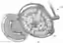 Fig. 01 - SMART HANDLE FOR SURGICAL LAMP
