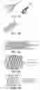 Fig. 09 - Biopsy marker