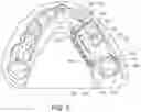 Fig. 06 - MODULAR ORTHODONTIC DEVICES AND METHODS FOR TREATMENT