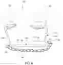 Fig. 07 - MODULAR ORTHODONTIC DEVICES AND METHODS FOR TREATMENT
