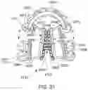 Fig. 22 - MODULAR ORTHODONTIC DEVICES AND METHODS FOR TREATMENT