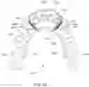 Fig. 35 - MODULAR ORTHODONTIC DEVICES AND METHODS FOR TREATMENT