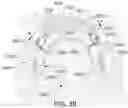 Fig. 41 - MODULAR ORTHODONTIC DEVICES AND METHODS FOR TREATMENT