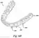 Fig. 09 - Dental implant positioning