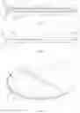 Fig. 05 - DENTAL MIXING PALETTE