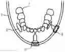 Fig. 01 - Device and method for measuring a movement of a mandible