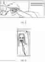 Fig. 07 - Device and method for measuring a movement of a mandible