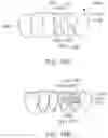 Fig. 13 - Modular aligner devices and methods for orthodontic treatment